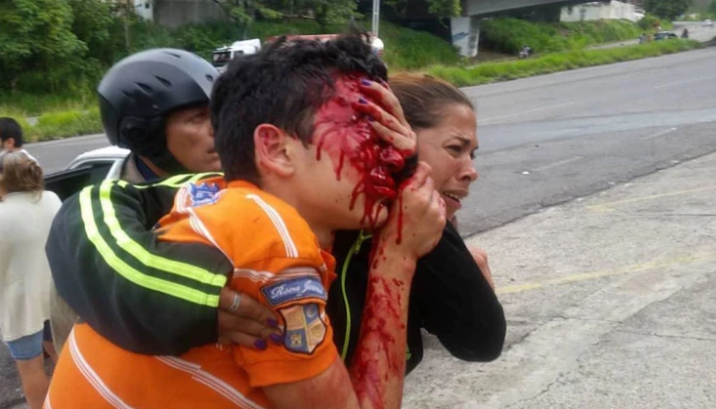 Brutal represión de Maduro dejó ciego a un adolescente de 16 años